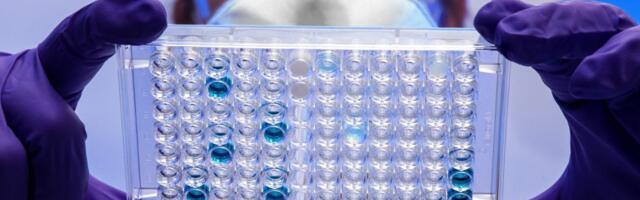 SAD: Odobren lek za Alchajmer