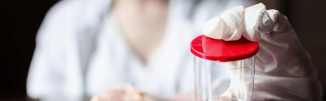 Slučaj trihineloze u Pančevu: Kako prepoznati simptome i zašto je pregled mesa ključan za zdravlje