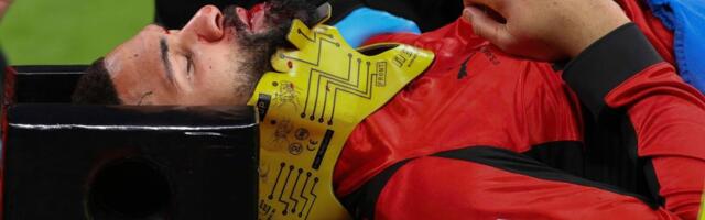 JEZIVE SCENE U MILANU: Loftus-Čik van terena osam nedelja zbog preloma vilice