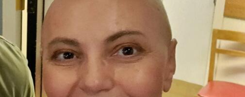 GLUMICA (53) OTKRILA DA JE POBEDILA OPAKU BOLEST, A SADA PONOVO IDE NA TERAPIJE: "Nažalost od ovog leka mi opet opadaju trepavice, obrve, kosa..."
