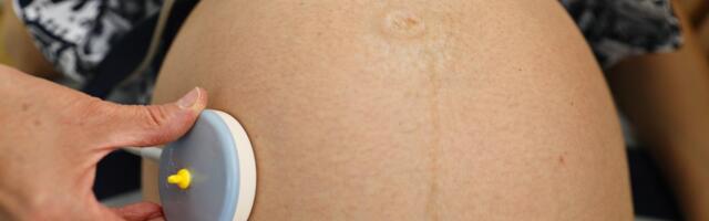 UNICEF i Ministarstvo zdravlja pokrenuli projekat za unapređenje zdravstvene nege trudnica i porodilja