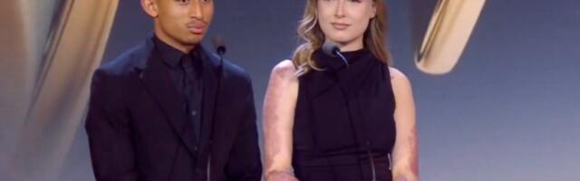 Fudbaler ju je vadio iz vatre, bila je u komi, sada ponosno pokazuje ožiljke: Jedva su se spasili (VIDEO)