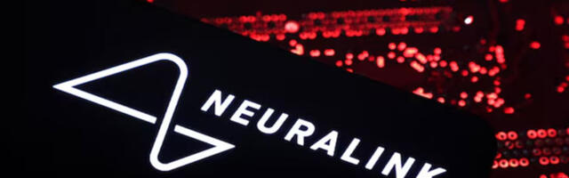 Neuralink dobio odobrenje za ispitivanje moždanog čipa u Kanadi
