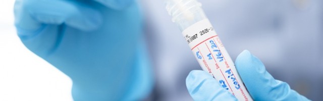 Još 210 novozaraženih, sedam preminulih