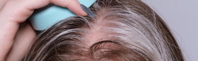 Može li seda kosa ponovo da potamni? Stručnjaci otkrili šta je mit, a šta istina