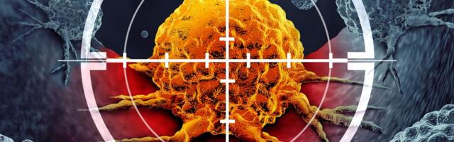 Ruski naučnici prvi put uništili tumor ULTRAZVUKOM