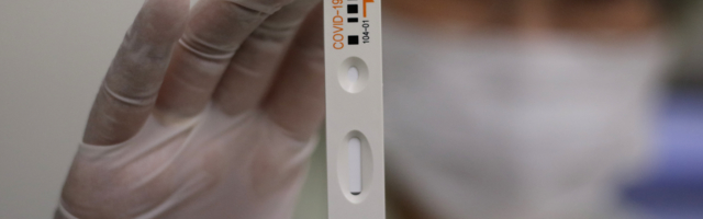 JOVANOVIĆ: Veliko interesovanje za testiranje na zahtev