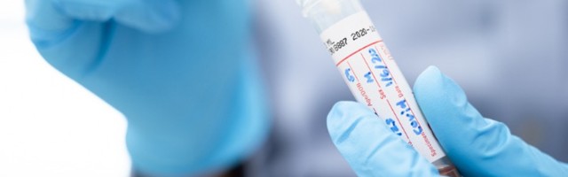 Skoro 800 novozaraženih, preminule tri osobe