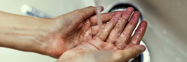 Deo Gorjana bez vode