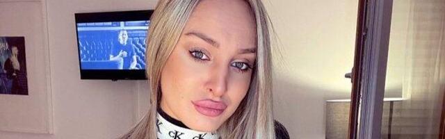 LUNA OPERISALA NOS, USTA I GRUDI! Đoganijeva promenila izgled u potpunosti!
