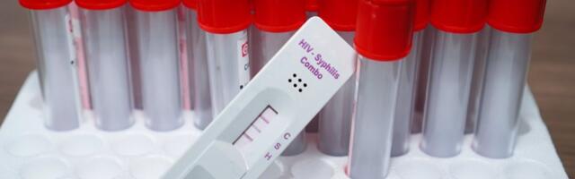 HIV otkriven kod 99 Srba, šest ljudi preminulo: Evo šta je najbitnije kod opake bolesti