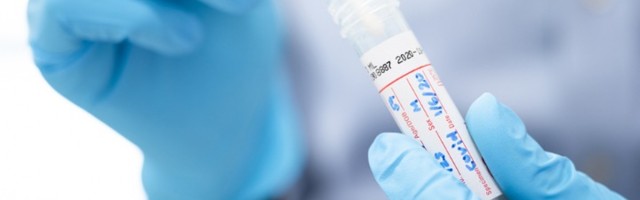 Ko bi mogao da bude zaštićen od delta soja korone?