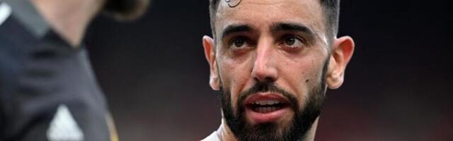 Bruno: Liverpul se bori za titulu, mi se ne borimo ni za šta