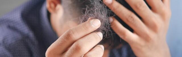 Najnovije naučno otkriće može ponuditi lek protiv ćelavosti