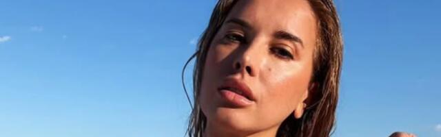 Prirodne sedmice u osipu i modricama: Nives Celzijus šokirala kadrovima poprsja (FOTO)