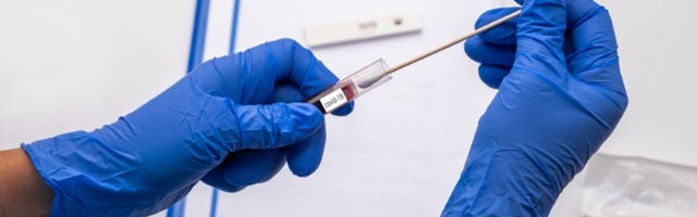 Na Kosovu još 13 umrlih, više od 500 novoobolelih