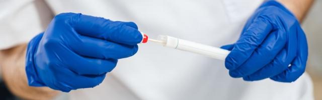 Umrlo još 50 pacijenata, skoro 6.500 novozaraženih