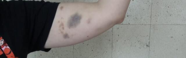 Ispovest studentkinje o prebijanju u Novom Pazaru: „Kada su videli da se nećemo skloniti počeli su da nas vuku za ruke i noge, a koleginicu su počupali za kosu“