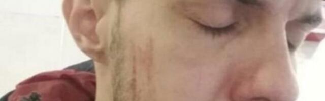 U TAJNOSTI PRIPREMIO SOPSTVENU SAHRANU! Pevač obezbedio sebi grobno mesto, a ovi detalji će vas NAJEŽITI!