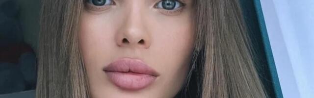 DEČKO ZVERSKI PREBIO ANŽELIKU, GLAVA PUNA HEMATOMA: Hvalila se luksuzom, ali je za to morala da radi OVO dečku!