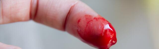 Lekari upozoravaju: Ove vrste krvarenja mogu biti znak raka - ne ignorišite signale