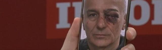 LEKARI SE BORE DA SPASU OKO BAĆIĆU: Ministar Lončar otkrio u kakvom je stanju povređeni policajac