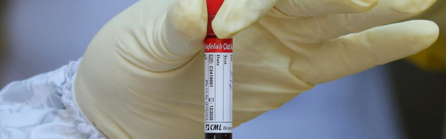 Na Dark webu krv COVID-19 pacijenata košta 3 puta više nego unajmiti ubicu