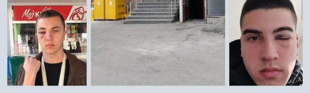 Prijepoljci o tuči: Policija nijemo posmatrala batinjanje i čekala pojačanje