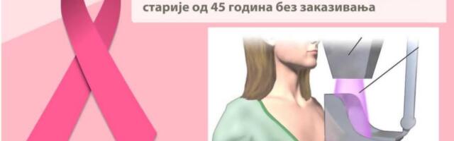 Otvorena vrata za mamografiju u Domu zdravlja Niš: Besplatni pregledi bez zakazivanja