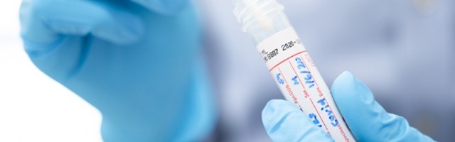 U Beogradu sve manje novozaraženih