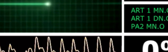 Nakon teškog infarkta Vilijam tvrdi da je na trenutak umro ali da se nije plašio