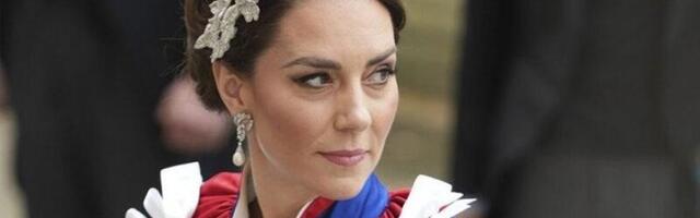 SRPSKI DOKTOR OTKRIO SVE O LEČENJU PRINCEZE KEJT MIDLTON! Šta je preventivna hemioterapija i kada se ona koristi?