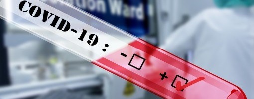 U RS 649 novih slučajeva koronavirusa, devet preminulih