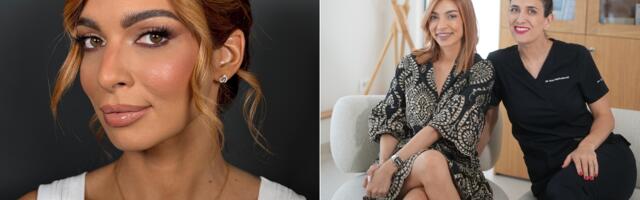 Lično iskustvo sa najtraženijim anti-age tretmanom: Šta zaista možete da očekujete od polinukleotida