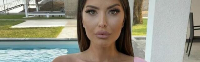"RADIM BOTOKS, ALI TO NE RAČUNAM" Ana Radulović otkrila šta je sve radila na sebi, a evo šta kaže o ružnim komentarima (VIDEO)