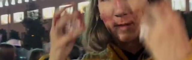 Student Vukašin Đinović povređen u sukobu s policijom: Nabio me je štitom u glavu, ničim izazvan