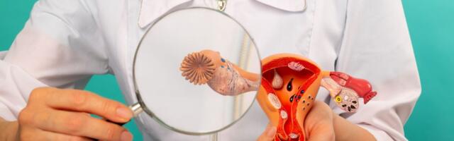 Nismo tražile čuda, već šansu: Terapija za HRD-pozitivne žene sa rakom jajnika konačno dostupna i besplatna