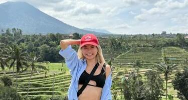 Slomljena lobanja i 50 šrafova u glavi promenili su joj život: Napustila je posao i muža i prodala sve svoje stvari