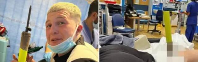 Engleski ragbista završio napad sa korner zastavicom zabijenom u nogu