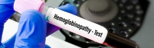 Namirnice koje dižu hemoglobin preko noći: Krvna slika se popravlja kao luda