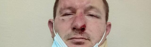 Podrinske: Napadač sa čekićem sa protesta u Šapcu pretukao komšiju
