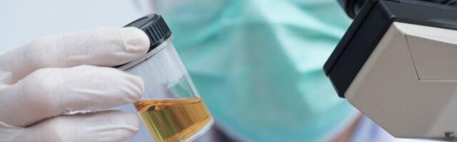 Osećate umor, glavobolju i imate tamnu boju urina? Evo šta vam poručuje organizam