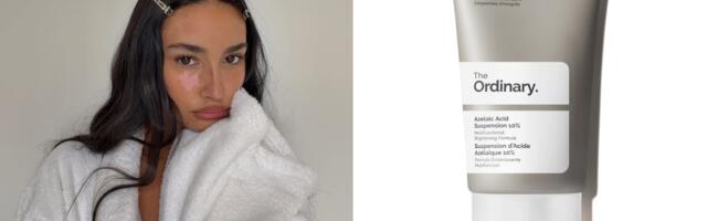 Azelaična kiselina je potcenjeni skincare sastojak – evo kako radi