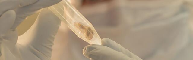 Opasna zaraza širi se u ovom delu sveta, proglašena vanredna situacija: Alarmantno u evropskoj zemlji