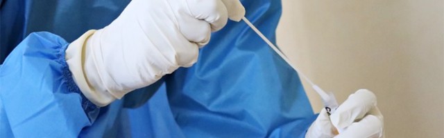 Još 227 novozaraženih, premunulo dvoje