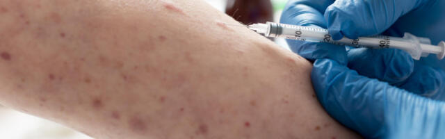 SZO: Brzo širenje epidemije malih boginja odnelo najmanje 30 života u Bangladešu