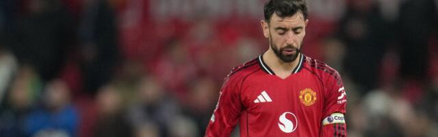 Sebičluk ili frustracija kapitena? Bruno udario na saigrače /FOTO/