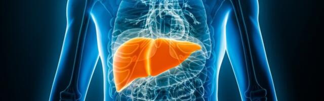 Prvi znak bolesne jetre javlja se na dlanovima: Deluje bezazleno, a zapravo je nešto mnogo gore