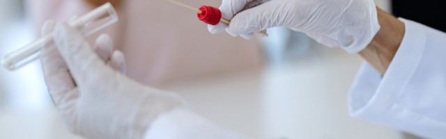 Obolele još 1.402 osobe, preminula 22 pacijenta