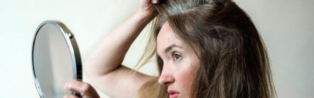 Ako primetite sedu kosu možda vam fali jedan vitamin: Nije uvek zbog starenja